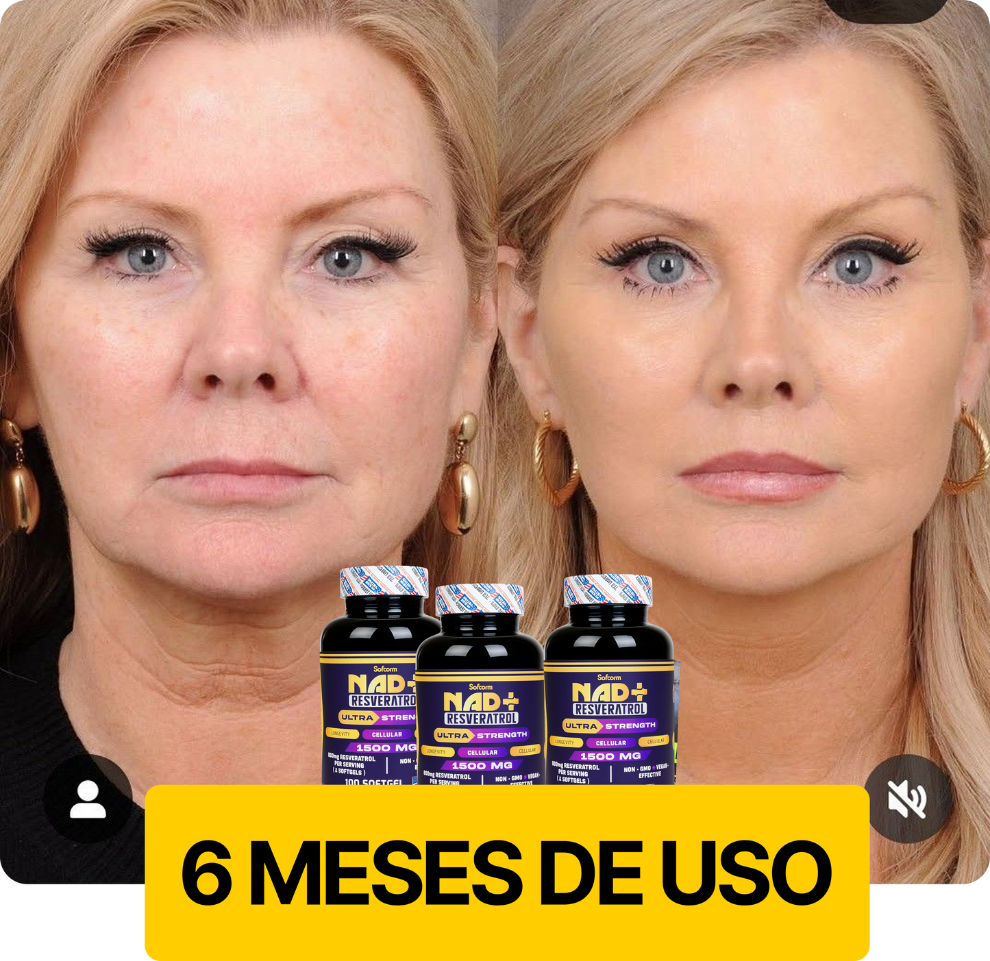 NAD RESVERATROL - OFERTA LIMITADA!